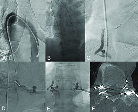 FIG 2.