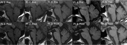 FIG 3.