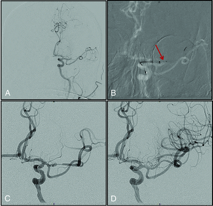 FIG 3.