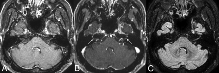 FIG 4.