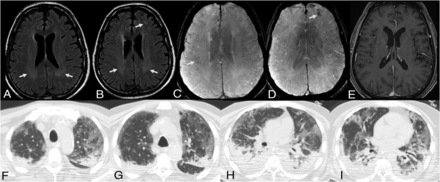 FIG 6.
