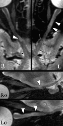 FIG 3.