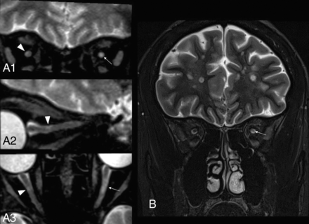FIG 4.