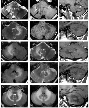 FIG 2.