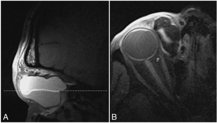 FIG 2.