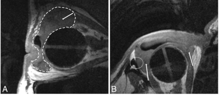FIG 3.