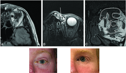 FIG 6.