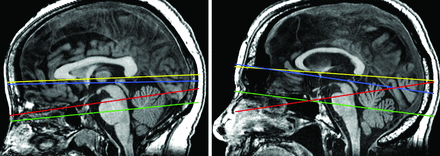FIG 1.