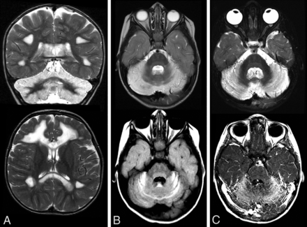FIG 4.