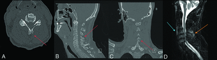 FIG 3.