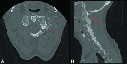 FIG 9.