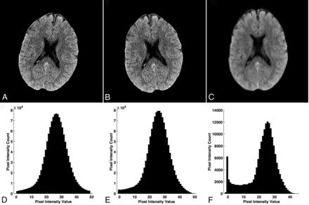 FIG 4.