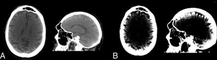 FIG 5.