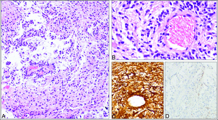 FIG 4.