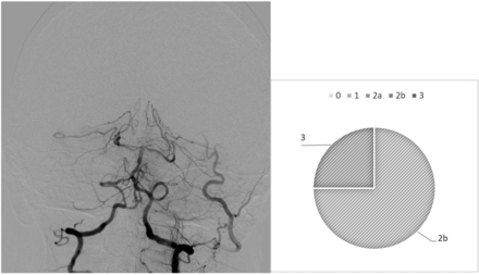 FIG 2.
