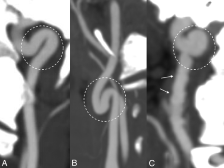 FIG 2.