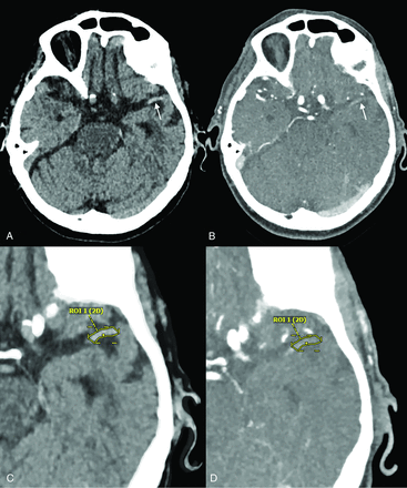Fig 2.