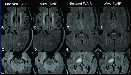 FIG 2.