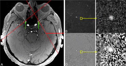 FIG 1.