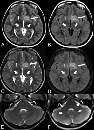 FIG 1.