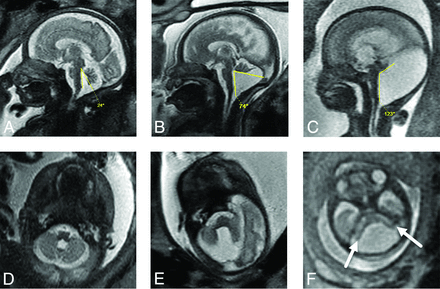 FIG 1.