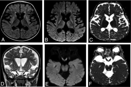 FIG 1.