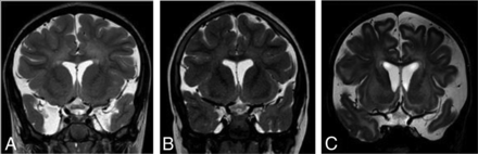 FIG 3.