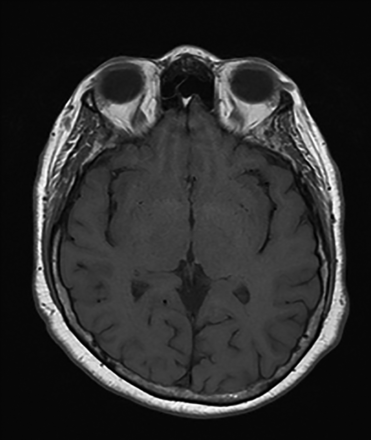 FIG 2.
