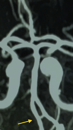 FIG 1.