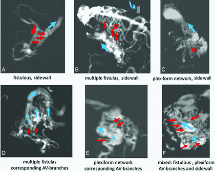 FIG 2.