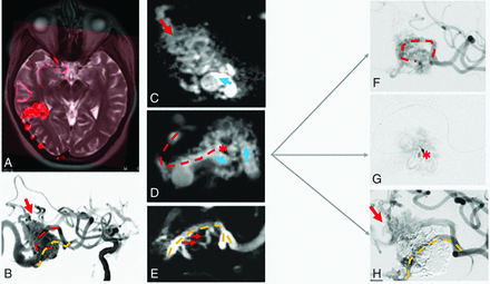 FIG 3.