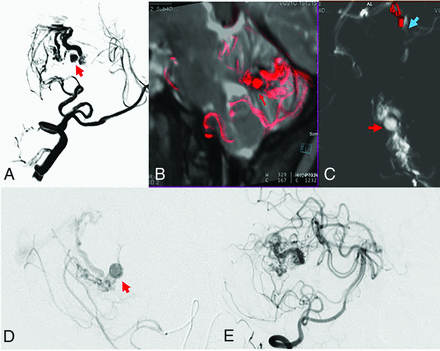 FIG 4.