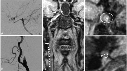 FIG 3.
