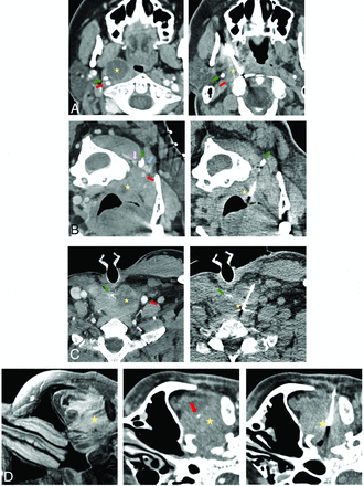FIG 2.