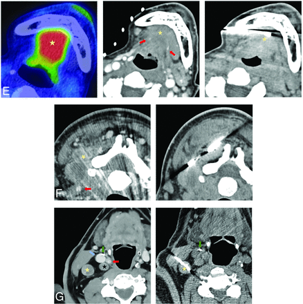 FIG 2.