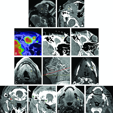 FIG 3.