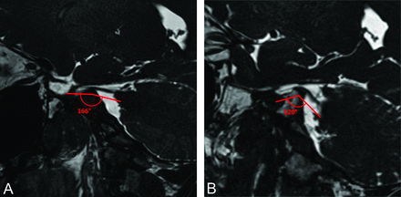 FIG 1.