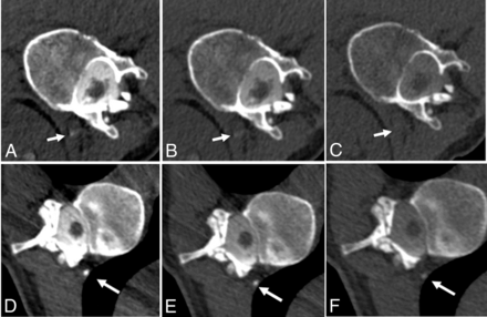 FIG 1.