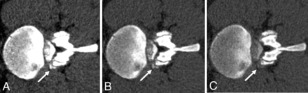 FIG 2.