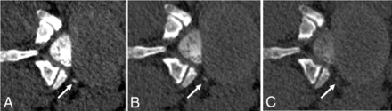 FIG 3.