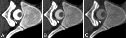FIG 4.
