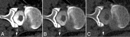 FIG 5.