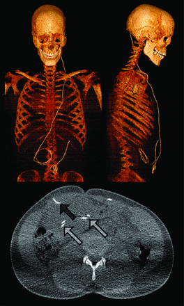 FIG 2.
