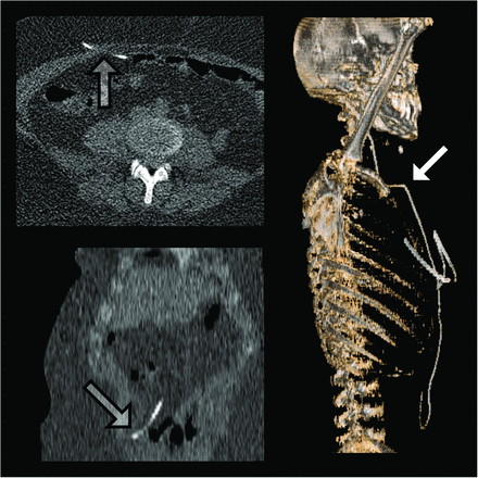 FIG 3.