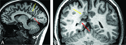 FIG 1.