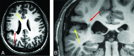 FIG 2.