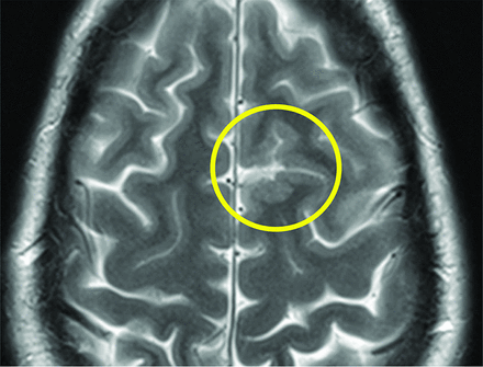 FIG 5.