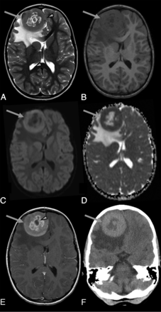 FIG 1.