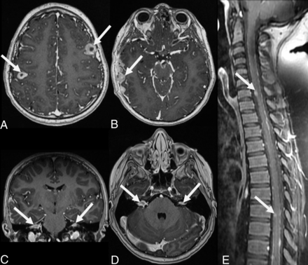 FIG 3.