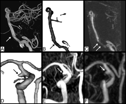 FIG 1.